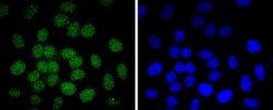 c-jun Rabbit anti-Human, Clone: JJ080-9, Novus Biologicals 100&mu;L:Antibodies,